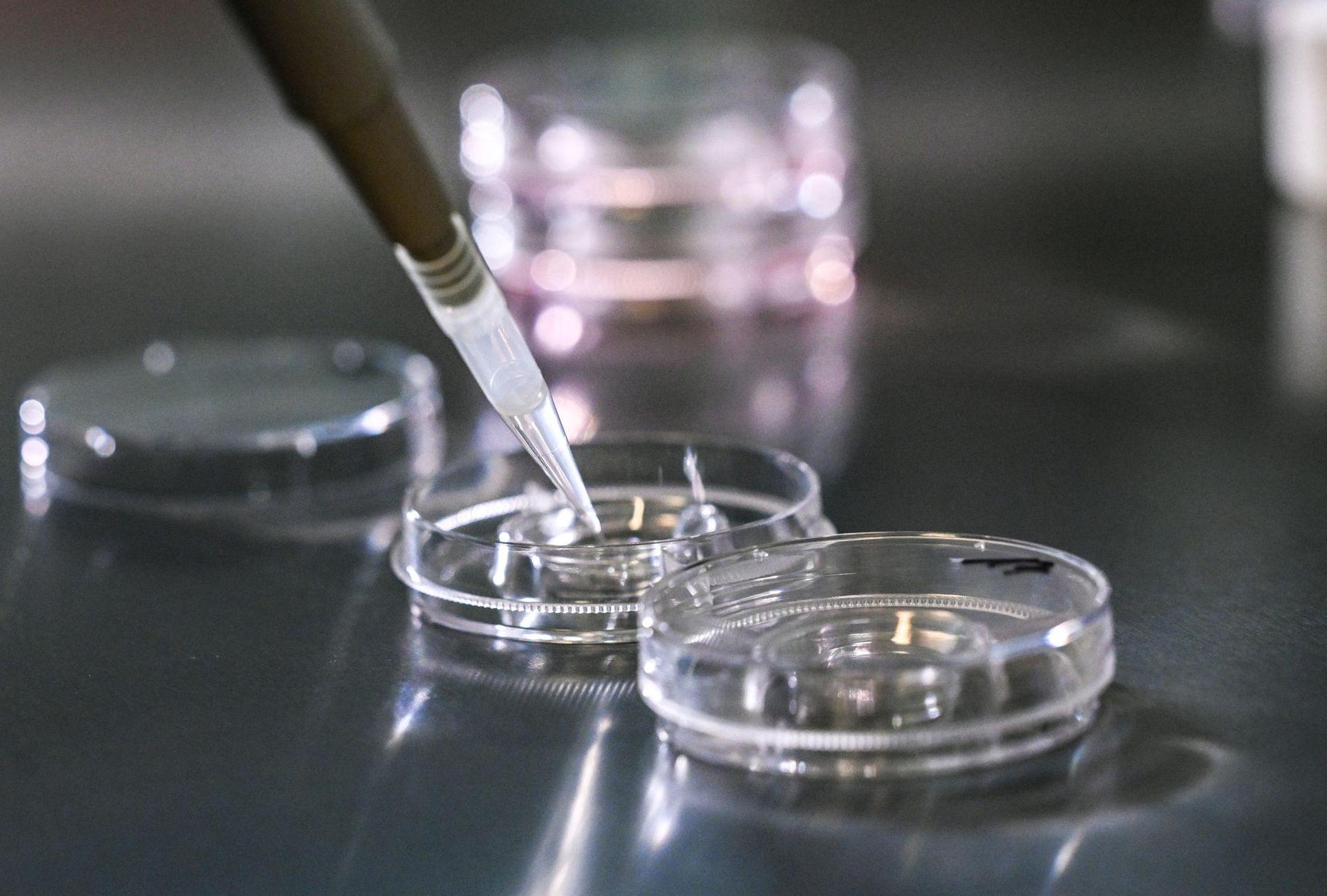 Bei einer In-vitro-Fertilisation werden Eizellen außerhalb des Körpers befruchtet. Der Soroptimist-International-Club Amberg-Sulzbach fordert nun, dass auch die Eizellspende in Deutschland legal wird. (Symbolbild: Jens Kalaene/dpa)