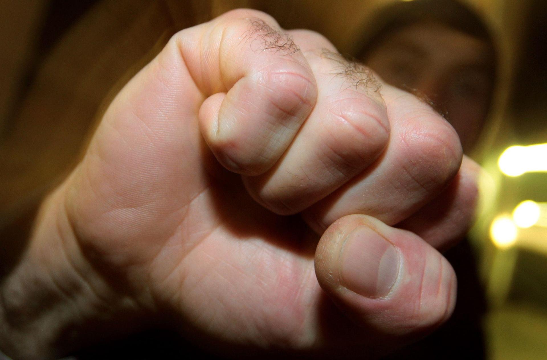 Ein Familienstreit in Sulzbach-Rosenberg endete mit einer Verletzten und mehreren Anzeigen. (Symbolbild: Karl-Josef Hildenbrand/dpa)